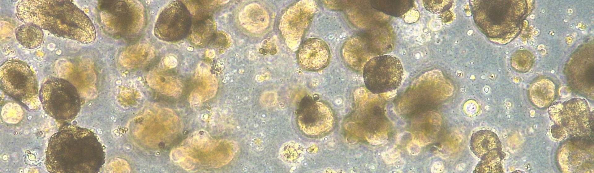 Colorectal organoids / Wellcome Sanger Institute