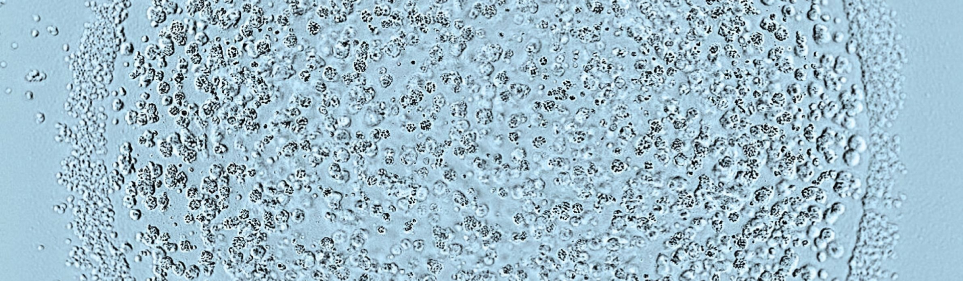 Matthew Coelho | Wellcome Sanger Institute