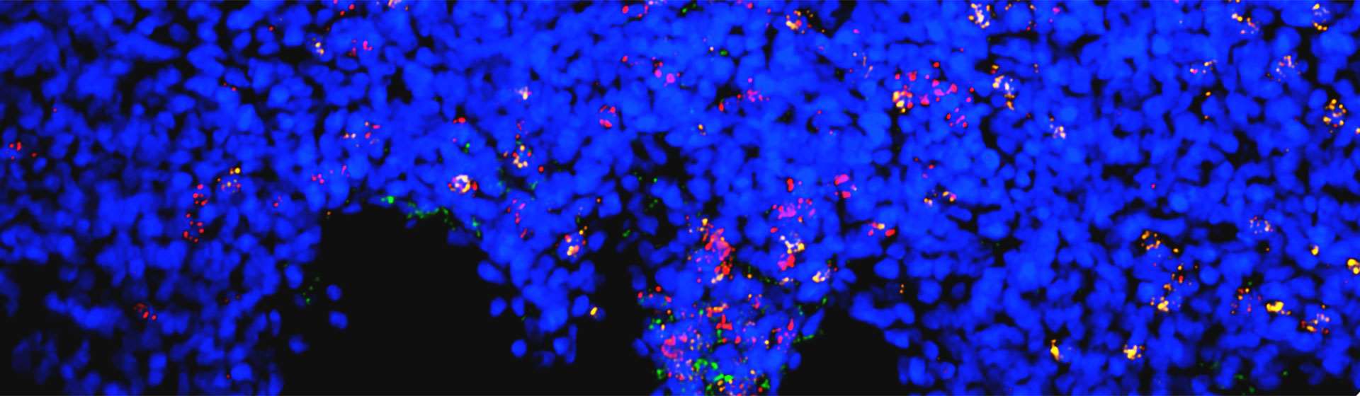 Elmentaite et al. Nature DOI: 10.1038/s41586-021-03852-1