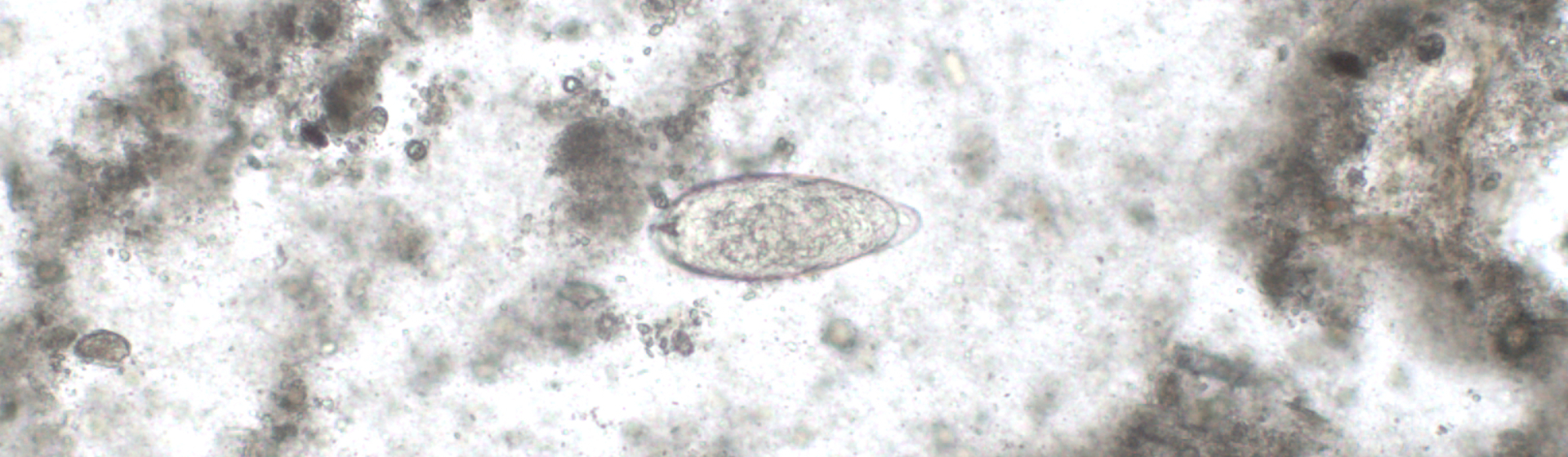 An egg from the parasite Schistosoma mansoni / Vivien Rolfe