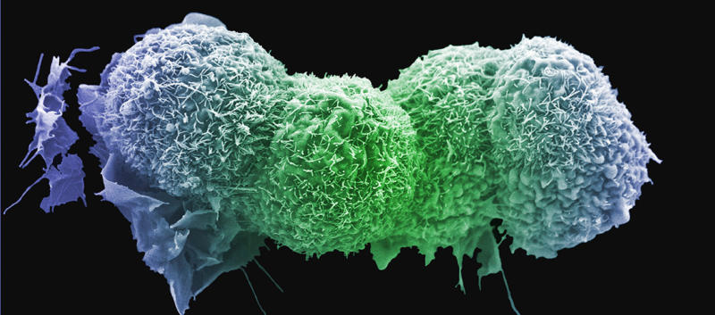 Anne Weston, Francis Crick Institute