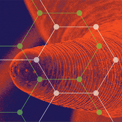 Genome Decoders: Human Whipworm