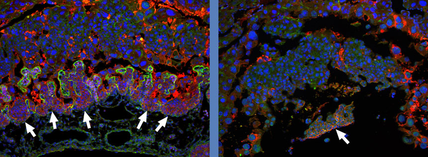 The placentas of two mouse embryos part way through development: unaffected embryo on the left and embryo with a mutation in the Nubpl gene on the right. The Nubpl gene affects development and leads to pre-natal death. The green staining on the left image show the exchange surface where nutrients are transferred between the mother and embryo, along with the red staining of cells underlying this exchange. The exchange surface and most of the cells underneath are missing in the embryo on the right. Image provided by the Babraham Institute