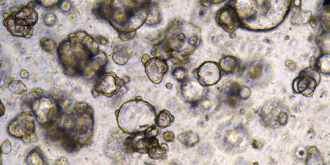 Organoid Cell Lines