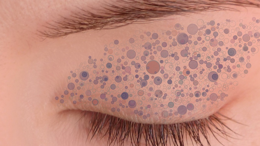 Tribes of cells carrying mutations in the eyelid