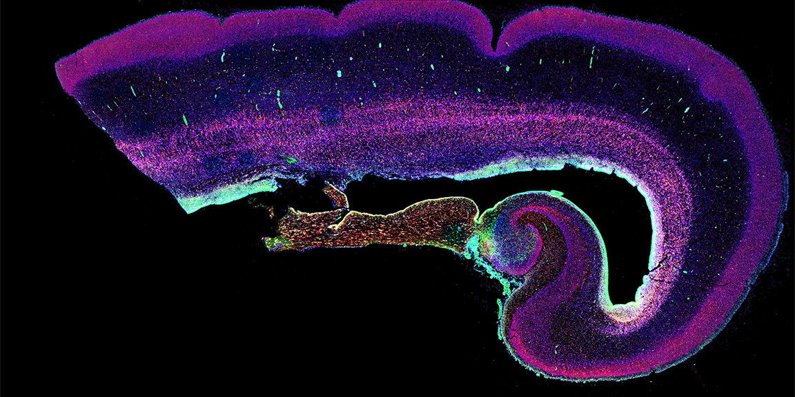 A Versatile flowcell for automation of cyclic microscopy