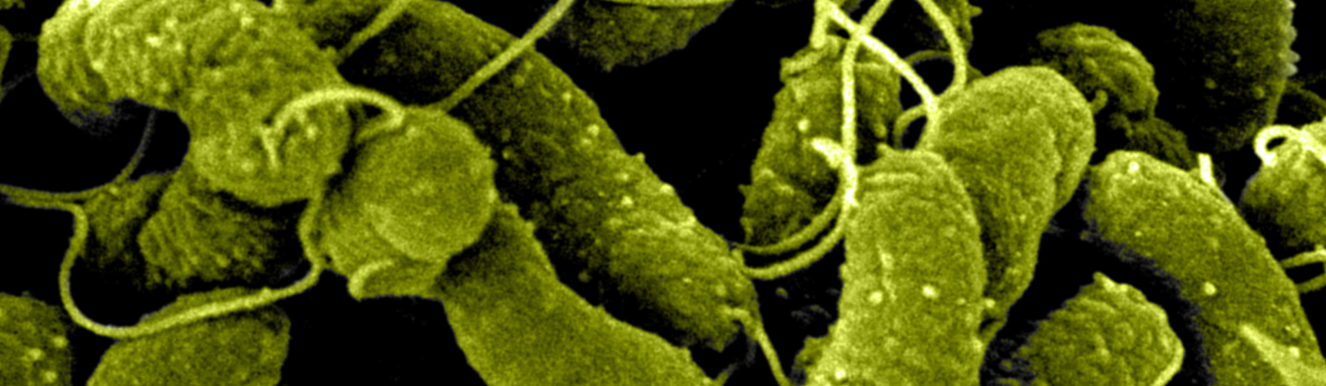 Vibrio cholerae bacteria. Dave Goulding / Wellcome Sanger Institute